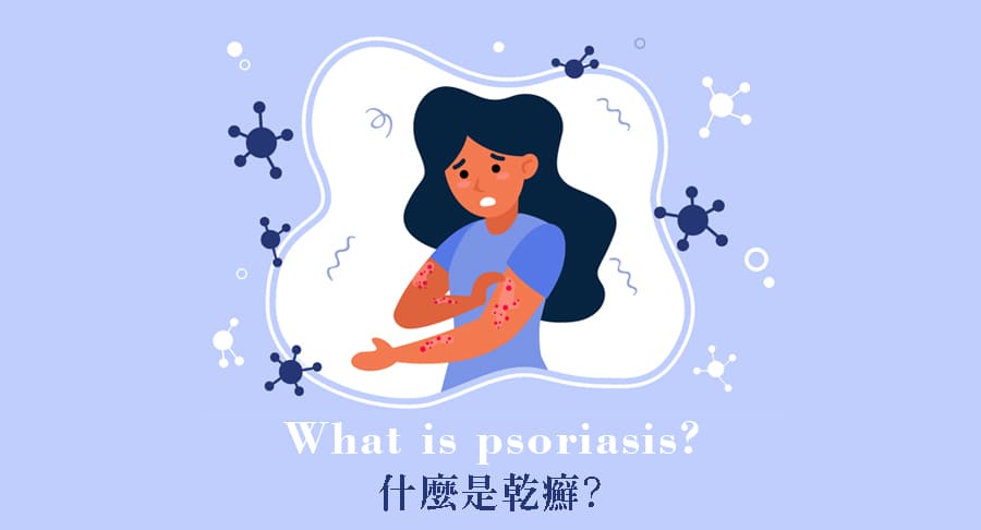 什麼是乾癬?